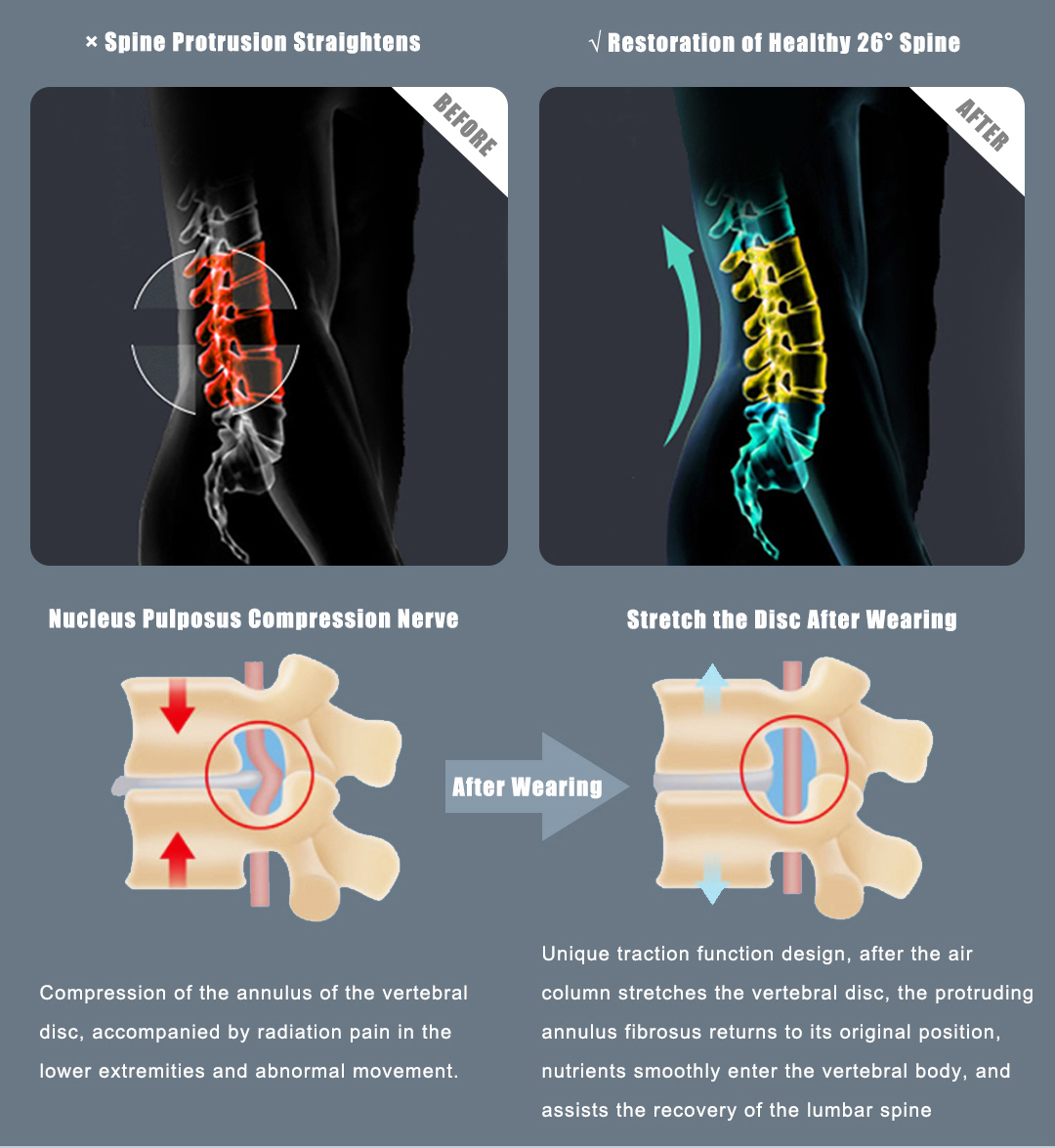 D30 Graphene Heated Airbag Lumbar Support Belt: spinal curvature illustration.
